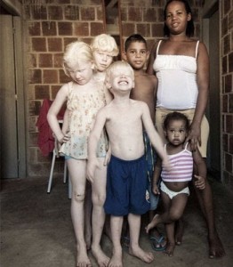 Padre negros con niños albinos