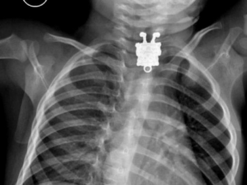 Radiografías insólitas