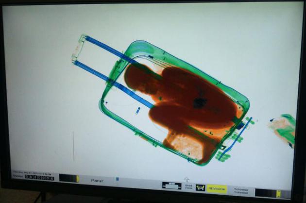 rayos X niño de 8 años en una maleta